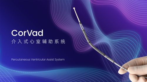 國產(chǎn)創(chuàng)新突破 深企介入式心室輔助系統(tǒng)獲批上市，填補(bǔ)國內(nèi)技術(shù)空白